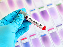 扬州要如何办理胎儿亲子鉴定